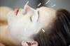 Alternative Treatments for Migraine: A Research Update Alternative Treatments for Migraine: A Research Update