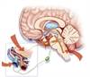 Cognitive Difficulties During Migraine Affect Functioning Cognitive Difficulties During Migraine Affect Functioning