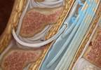 Updated Guidelines on Intrathecal Therapy for Pain Updated Guidelines on Intrathecal Therapy for Pain