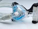 Obstructive Sleep Apnea in Asthma: Gaining Control by Losing Weight Obstructive Sleep Apnea in Asthma: Gaining Control by Losing Weight
