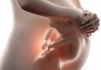 Risk of Zika Virus-Related Birth Defects in Pregnant Women Risk of Zika Virus-Related Birth Defects in Pregnant Women