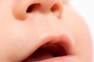 People who develop Dravet syndrome often face oral motor dysfunction, affecting language abilities. People who develop Dravet syndrome often face oral motor dysfunction, affecting language abilities.