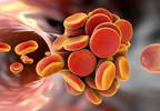 Expert Consensus: Managing Bleeding in Patients Taking Oral Anticoagulants Expert Consensus: Managing Bleeding in Patients Taking Oral Anticoagulants