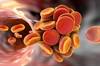 Expert Consensus: Managing Bleeding in Patients Taking Oral Anticoagulants Expert Consensus: Managing Bleeding in Patients Taking Oral Anticoagulants