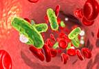 Sepsis Associated With Long-term Seizure Risk Sepsis Associated With Long-term Seizure Risk
