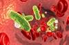 Sepsis Associated With Long-term Seizure Risk Sepsis Associated With Long-term Seizure Risk