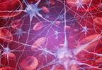 Intracerebral Hemorrhage Outcomes Improved With Anticoagulants Intracerebral Hemorrhage Outcomes Improved With Anticoagulants