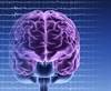 Late-Onset Epilepsy Linked to Diabetes Late-Onset Epilepsy Linked to Diabetes