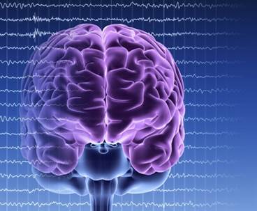 Late-Onset Epilepsy Linked to APOE ε4, Smoking, Diabetes Late-Onset Epilepsy Linked to APOE ε4, Smoking, Diabetes