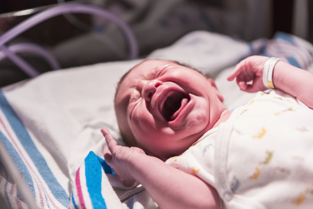 Buprenorphine Superior To Morphine In Neonatal Abstinence Syndrome