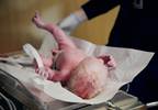 Nusinersen Improves Motor Function, Survival in Infants With Spinal Muscular Atrophy Nusinersen Improves Motor Function, Survival in Infants With Spinal Muscular Atrophy