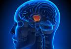 Hypothalamus May Play a Central Role in Chronic Migraine Hypothalamus May Play a Central Role in Chronic Migraine
