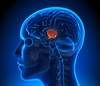 Disrupted Thalamo-Striato-Hypothalamic Function May Serve as a Good Biomarker for Parkinson Disease Disrupted Thalamo-Striato-Hypothalamic Function May Serve as a Good Biomarker for Parkinson Disease
