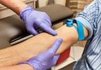 Blood Test to Detect Fibromyalgia Now Available Blood Test to Detect Fibromyalgia Now Available