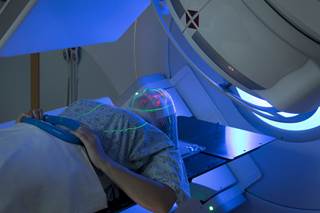 In the stereotactic radiosurgery group, 24% of patients developed local recurrence compared with 48% of patients in the observation group. In the stereotactic radiosurgery group, 24% of patients developed local recurrence compared with 48% of patients in the observation group.