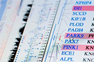 The investigators hope that the risk score will be a good tool for clinical trial design, and eventually clinical practice. The investigators hope that the risk score will be a good tool for clinical trial design, and eventually clinical practice.