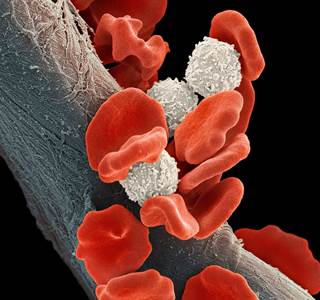 The most common types of cancer evaluated included colon/rectal cancer, female breast cancer, and leukemia. The most common types of cancer evaluated included colon/rectal cancer, female breast cancer, and leukemia.