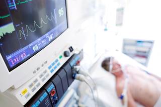 Within 5 days of initiating brexanolone infusion, 16 patients were successfully weaned off TLAs without anesthetic agent reinstatement. Within 5 days of initiating brexanolone infusion, 16 patients were successfully weaned off TLAs without anesthetic agent reinstatement.