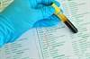Cannabidiol May Impact Antiepileptic Drug Levels in Refractory Epilepsy Cannabidiol May Impact Antiepileptic Drug Levels in Refractory Epilepsy