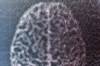 Buccal, Nasal Midazolam Most Cost-Effective for Pediatric Status Epilepticus Buccal, Nasal Midazolam Most Cost-Effective for Pediatric Status Epilepticus
