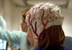Increased Risk of Unnatural Death in People With Epilepsy Increased Risk of Unnatural Death in People With Epilepsy