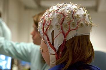 Treatment of New-Onset Epilepsy: AAN, AES Update Practice Guidelines Treatment of New-Onset Epilepsy: AAN, AES Update Practice Guidelines