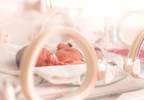Caffeine Therapy for Apnea of Prematurity Safe Over Long Term Caffeine Therapy for Apnea of Prematurity Safe Over Long Term