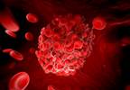 Moderate, Severe Obstructive Sleep Apnea Associated With Hypercoagulability Moderate, Severe Obstructive Sleep Apnea Associated With Hypercoagulability