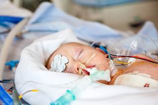 The MRIs showed the volume of white matter was lower among the children who underwent general anesthesia. The MRIs showed the volume of white matter was lower among the children who underwent general anesthesia.