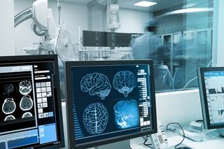 Patients who received both mechanical thrombectomy and IV tPA had lower mortality and better functional outcomes. Patients who received both mechanical thrombectomy and IV tPA had lower mortality and better functional outcomes.
