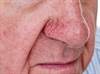 Predictors of Conversion to Neurodegenerative Disease in REM Sleep Behavior Disorder Predictors of Conversion to Neurodegenerative Disease in REM Sleep Behavior Disorder