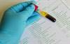 Dementia Associated With Serum Magnesium Levels Dementia Associated With Serum Magnesium Levels