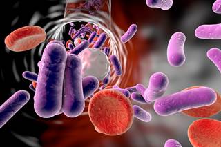 Patients with sepsis face a greater long-term risk of seizures than the general population. Patients with sepsis face a greater long-term risk of seizures than the general population.