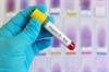 Vitamin D Deficiency May Contribute to Elevated Interleukin-6 in Psychosis Vitamin D Deficiency May Contribute to Elevated Interleukin-6 in Psychosis