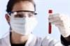 Tuberculosis Detection May Be Affected by Blood Draw Method Tuberculosis Detection May Be Affected by Blood Draw Method