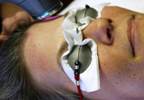 Near-Infrared Light Therapy Effective for Comorbid Depression, TBI Near-Infrared Light Therapy Effective for Comorbid Depression, TBI