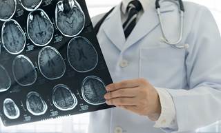 These patients discontinued treatment with interferon beta-1a and initiated treatment with alemtuzumab. These patients discontinued treatment with interferon beta-1a and initiated treatment with alemtuzumab.