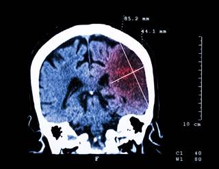 Odds of being in complete mental health up more than fourfold for those with at least one confidant. Odds of being in complete mental health up more than fourfold for those with at least one confidant.