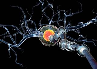 Compared with controls, MS patients had higher nerve proton-spin-density. Compared with controls, MS patients had higher nerve proton-spin-density.