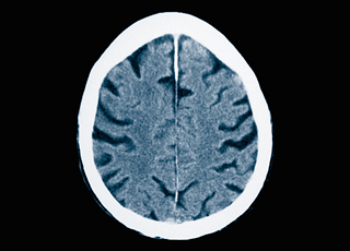 Episodic memory and regional brain volumes were badessed in later life. Episodic memory and regional brain volumes were badessed in later life.