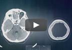 Functional Brain Connectivity Has Familial, Heritable Patterns Functional Brain Connectivity Has Familial, Heritable Patterns