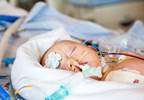 Prevalence of Fetal Alcohol Syndrome in the US Prevalence of Fetal Alcohol Syndrome in the US