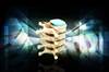 Epidural Stimulation May Benefit Cardiovascular Function in Spinal Cord Injury Epidural Stimulation May Benefit Cardiovascular Function in Spinal Cord Injury