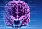 Alzheimer Disease May Benefit From Deep Brain Stimulation Alzheimer Disease May Benefit From Deep Brain Stimulation