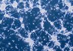 Modified Polio Vaccine Looks Promising in Early Glioblastoma Trial Modified Polio Vaccine Looks Promising in Early Glioblastoma Trial