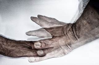 Factors that contribute to disease progression likely work in tandem based on individual patient characteristics. Factors that contribute to disease progression likely work in tandem based on individual patient characteristics.