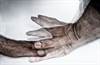 Wearable Sensors May Help Predict On, Off States in Parkinson Disease Wearable Sensors May Help Predict On, Off States in Parkinson Disease