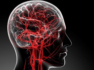 Lomerizine Increases Cerebral Blood Flow And Reduces Migraine