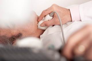 Carotid artery stenosis causes up to 10% of all ischemic strokes. Carotid artery stenosis causes up to 10% of all ischemic strokes.