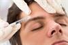 OnabotulinumtoxinA Therapy May Reduce Frequency, Severity of New Daily Persistent Headache OnabotulinumtoxinA Therapy May Reduce Frequency, Severity of New Daily Persistent Headache